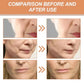 Firming Hydrocrystalline Patch – Anti-Aging Facial Mask