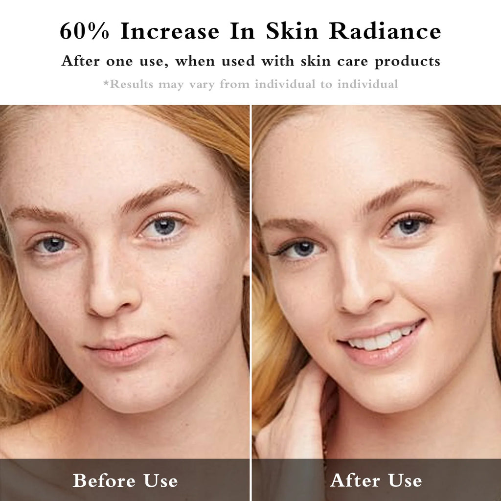 Facial EMS + IPL Skin Rejuvenation Beauty Device