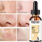 AHA Peeling Serum – Salicylic Acid Acne & Pore Treatment