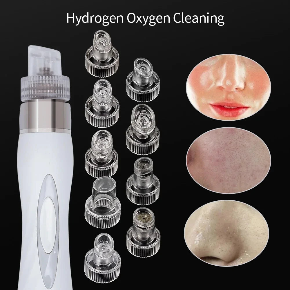 45PCS Facial Hydra Dermabrasion Tips Head Replacement For Water Oxygen Jet Peel