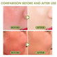 SPF Face Sunscreen Stick – Matte Oil-Control UV Cream