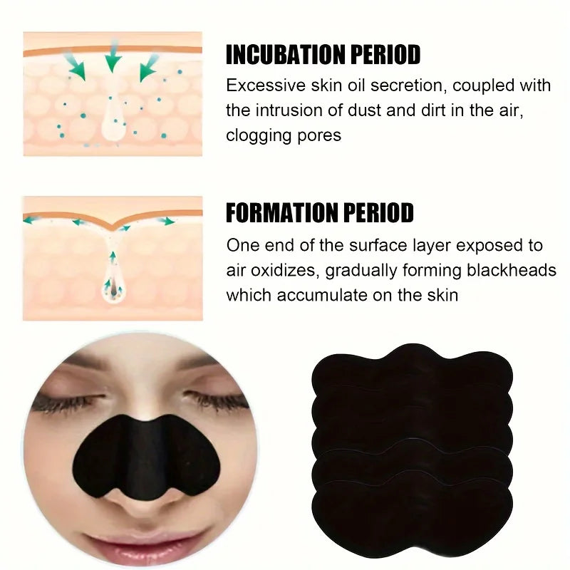 Blackhead Remover Nose Patches – Deep Cleansing (10/50/100pcs)