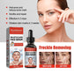Niacinamide & Salicylic Acid Serum – Sensitive Skin Repair