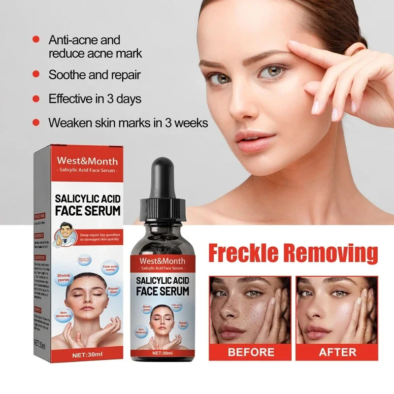 Niacinamide & Salicylic Acid Serum – Sensitive Skin Repair