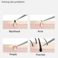 1/11Pcs Acne Pimples Blackhead Remover Clip Ultra-fine Tweezers Black Dots Blackhead Extractor Acne Needle Facial Cleaner Skin
