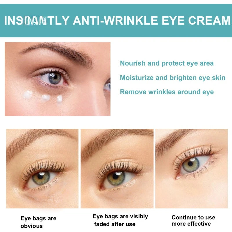 Anti-Wrinkle Eye Cream – Moisturizing & Firming Care