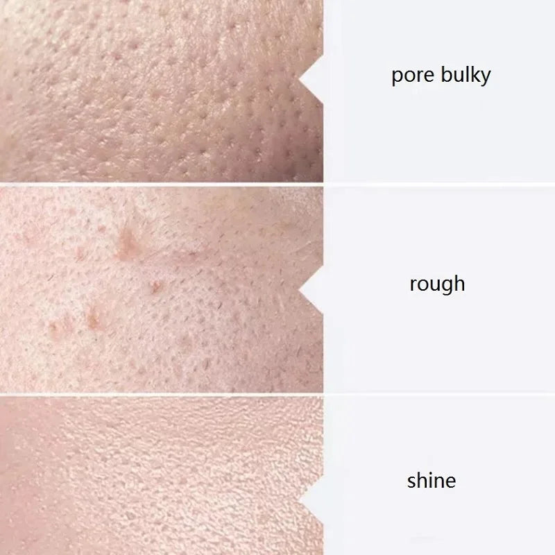 Aqua Peel Facial Serum Kit (3 x 400ml)