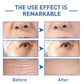 Retinol Wrinkle Remover Face Serum – Anti-Aging & Lifting