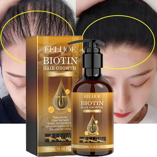 Biotin Hair Growth Shampoo – Anti-Hair Loss Treatment