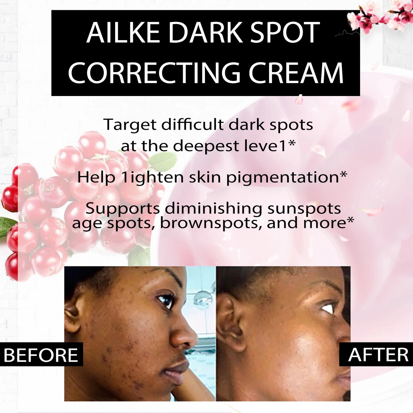 AILKE Bleaching Cream – Dark Spot Remover for Body & Face