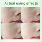Salicylic Acid Pore Cream – Blackhead & Skin Repair Care