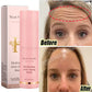 Instant Wrinkle Removal Balm – Collagen Anti-Aging Cream