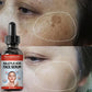Niacinamide & Salicylic Acid Serum – Sensitive Skin Repair