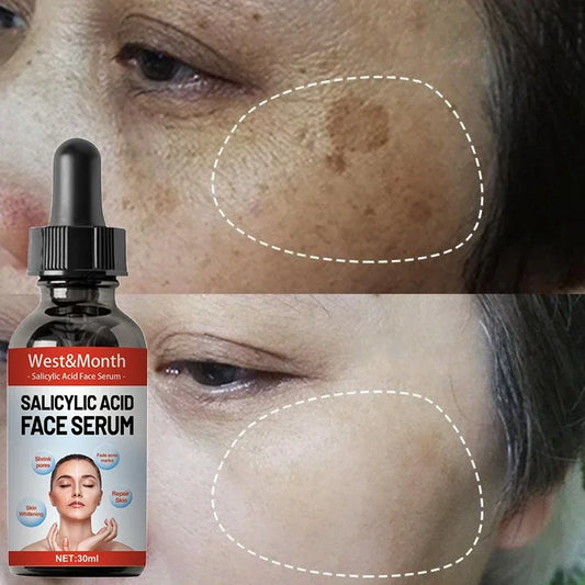 Niacinamide & Salicylic Acid Serum – Sensitive Skin Repair