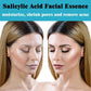 Facial Skin Peel Serum – Chemical Peel for Acne & Wrinkles
