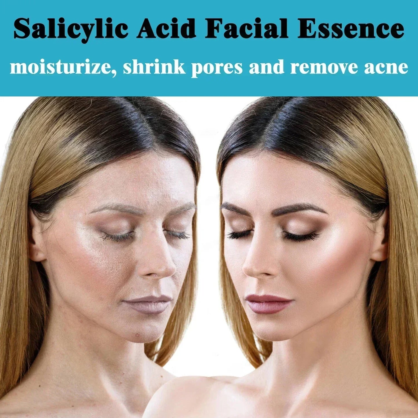 Facial Skin Peel Serum – Chemical Peel for Acne & Wrinkles