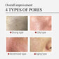 Salicylic Acid Pore Cream – Blackhead & Skin Repair Care