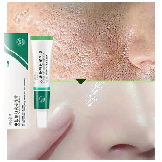 Salicylic Acid Pore Cream – Blackhead & Skin Repair Care