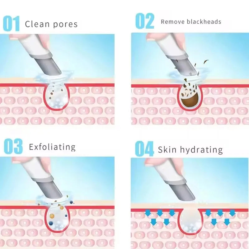 3-in-1 Hydra Peel Dermabrasion System — Deep Cleanse & Revitalize
