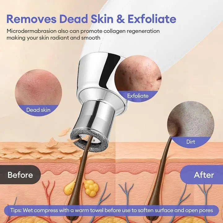 DiamondGlow Professional Resurfacing System