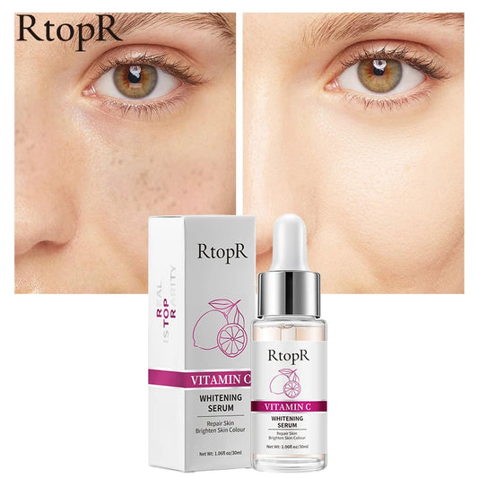 RtopR Vitamin C Whitening Serum – Brightening & Moisturizing
