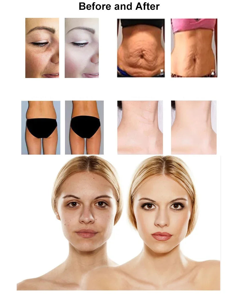 2025 448khz Tecar Therapy Machine – Slimming & Skin Firming