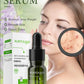 Salicylic Acid Acne Serum – Pore & Oil Control Treatment