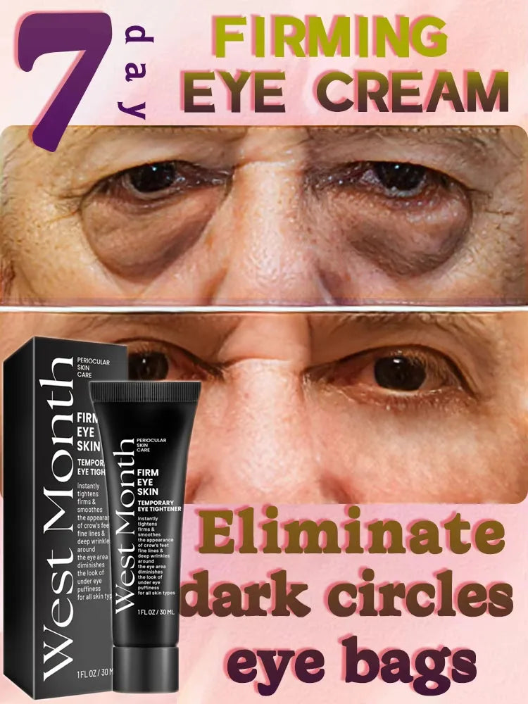 Eye Bag Removal Cream – Anti-Puffiness & Firming