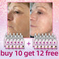 Wrinkle Removal Serum – Anti-Aging Face Lifting