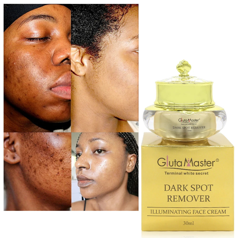 Gluta Maste Dark Spot Cream – Pore Minimizer & Anti-Acne Brightening