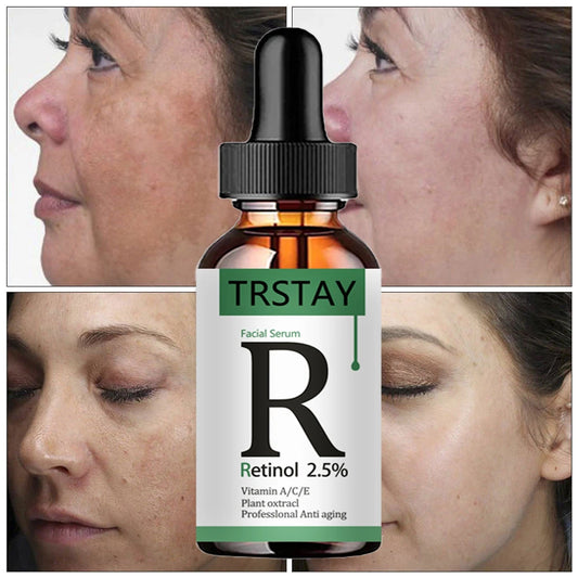Retinol 2.5% & Vitamin C Serum – Anti-Aging & Whitening Essence