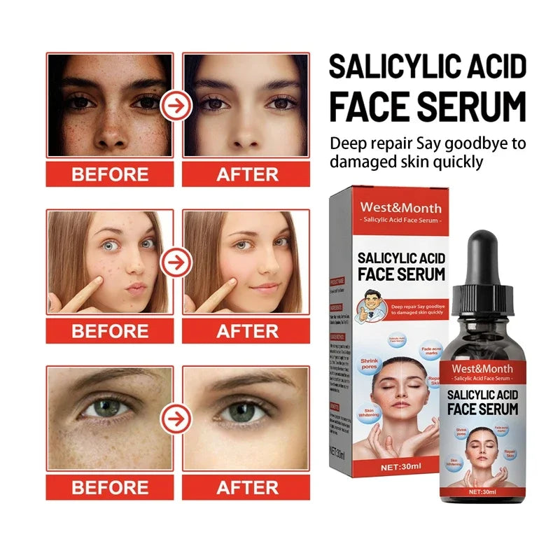 Niacinamide & Salicylic Acid Serum – Sensitive Skin Repair