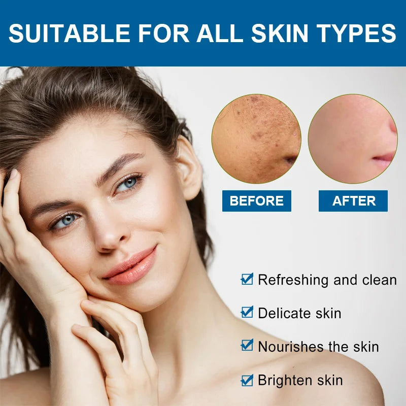 Oligopeptide Anti-Acne Serum – EGF Repair & Moisturizing