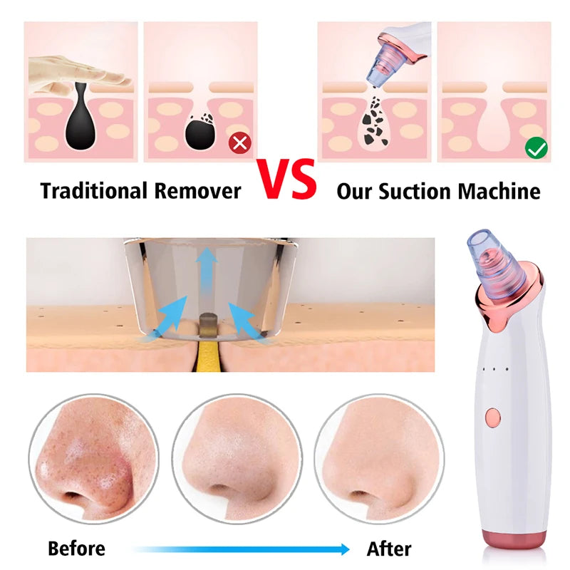 USB Rechargeable Nose Vacuum Blackhead Remover Pore Extractor Tool