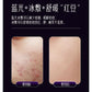 Multi-Function Beauty Device - EMS, Cryo Therapy & LED for Face Lifting & Rejuvenation