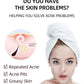 Acne Face Cream – Pimple Treatment & Oil Control Care