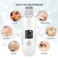 Ultrasonic Facial Cleaner – Acne & Blackhead Removal Device