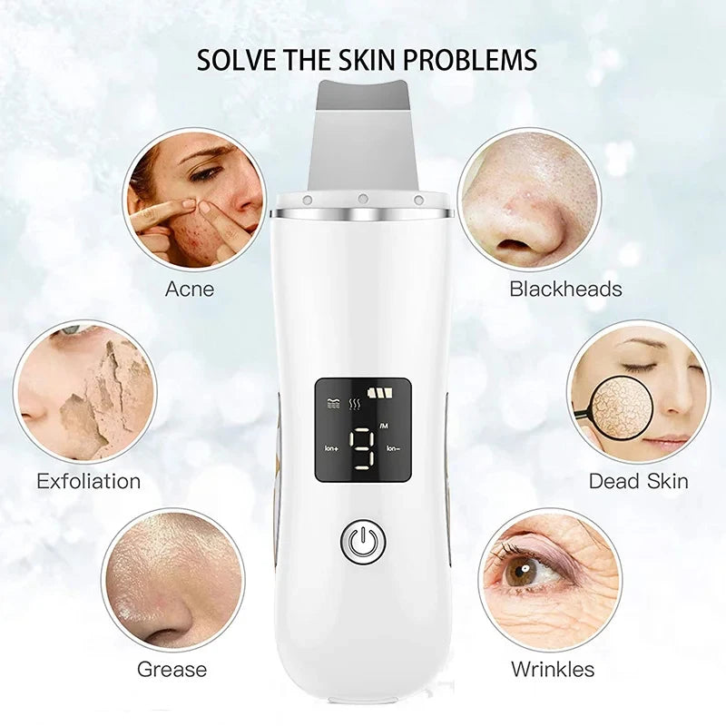 Ultrasonic Facial Cleaner – Acne & Blackhead Removal Device