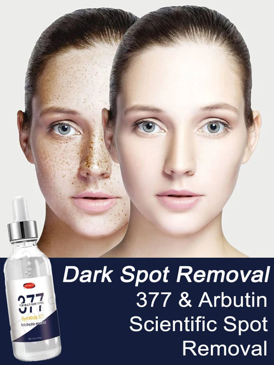 Whitening & Spot Removal Essence – Serum 377