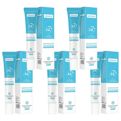 Acne Face Cream – Pimple Treatment & Oil Control Care