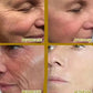 Wrinkle Remover Face Serum – Anti-Aging & Skin Firming