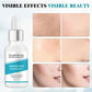Facial Skin Peel Serum – Chemical Peel for Acne & Wrinkles