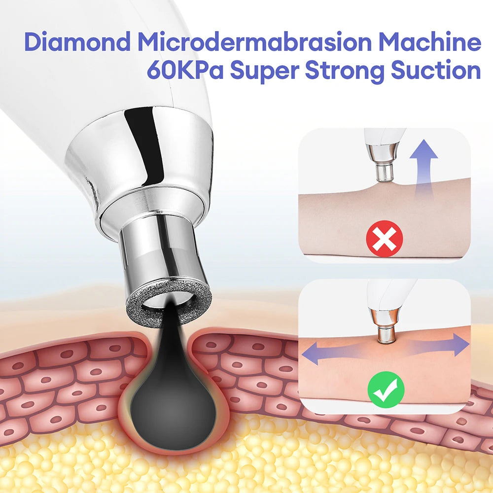 DiamondGlow Professional Resurfacing System
