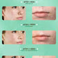 Facial Skin Peel Serum – Chemical Peel for Acne & Wrinkles