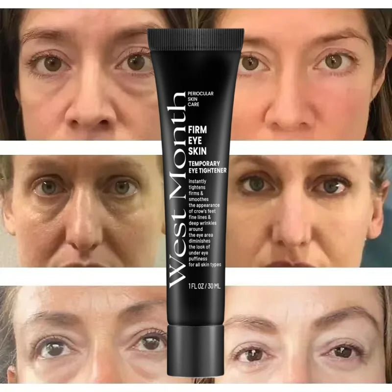 Eye Bag Removal Cream – Anti-Puffiness & Firming
