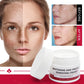 Whitening Freckle Cream – Dark Spot & Melasma Remover