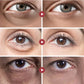 Fat Granules Remover Eye Cream – Anti-Wrinkle & Firming