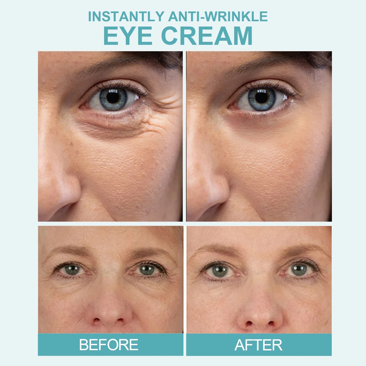Anti-Wrinkle Eye Cream – Moisturizing & Firming Care