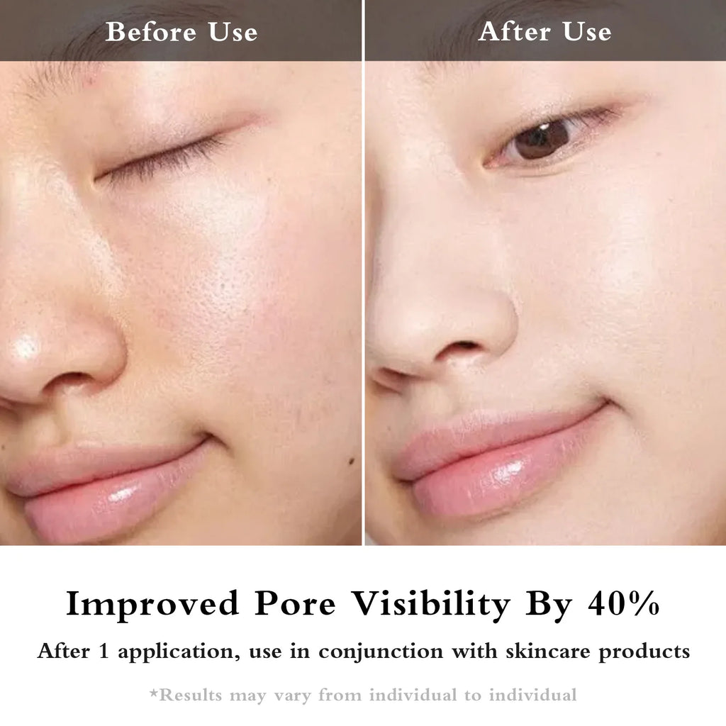 Facial EMS + IPL Skin Rejuvenation Beauty Device