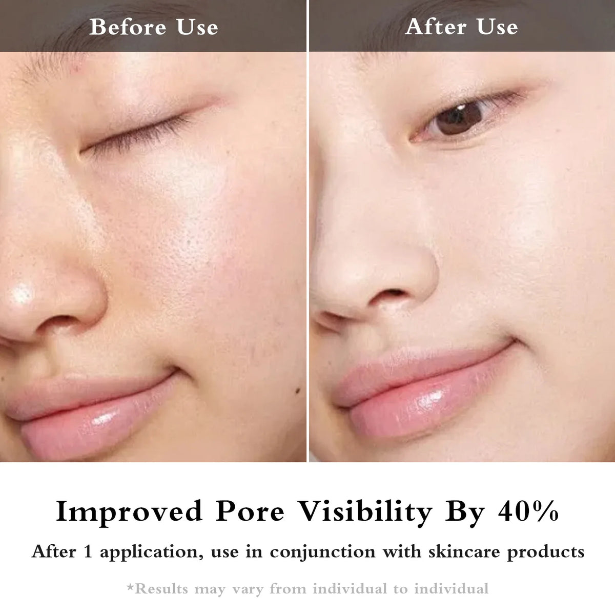 Facial EMS + IPL Skin Rejuvenation Beauty Device - image 3